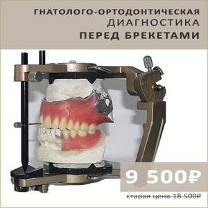 Акция гнатолого-ортодонтическая диагностика перед брекетами