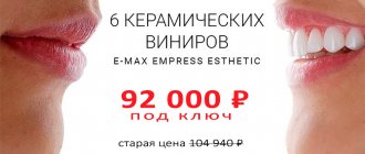 Promotion for 6 veneers for 92,000