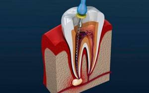 Болезни полости рта - Стоматология «Линия Улыбки»