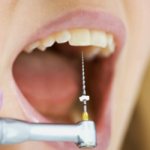 Болит депульпированный зуб - Стоматология Линия Улыбки