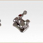 брекет система gemini