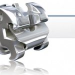 Брекеты In Ovation