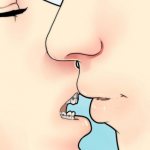 Брекеты на зубах – как можно целоваться