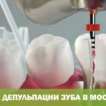 Цена депульпации зуба в Москве