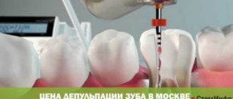 Цена депульпации зуба в Москве