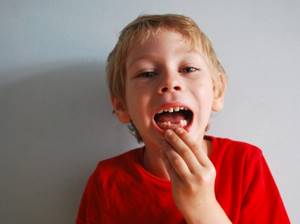 Что делать, если у ребенка начали криво расти зубы