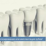 что лучше протезирование или имплантация зубов.jpg