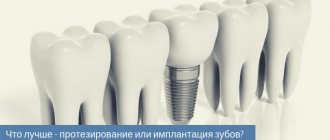что лучше протезирование или имплантация зубов.jpg