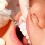 Что входит в профессиональную чистку зубов в стоматологии