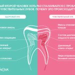 Чувствительные зубы