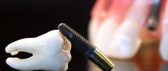 zirconium implants