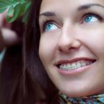 Эстетические брекеты. Виды и возможности систем