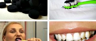 Stages of teeth whitening