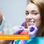 Фото девушки во время подбора цвета зубов по шкале Vita
