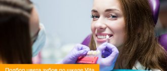 Photo of a girl while selecting teeth color using the Vita scale