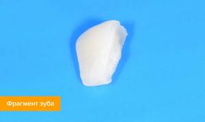 Фото фрагмента зуба