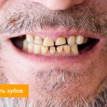 Фото мужчины, который страдает стираемостью зубов