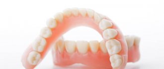 Photos of removable dentures