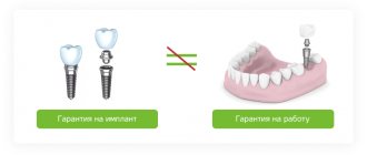 гарантия на зубной имплант