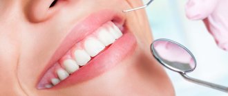Purulent gingivitis