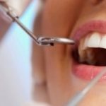 Имплант Импро