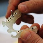 Изготовление хирургического шаблона