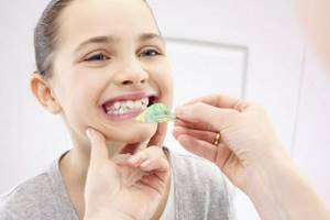 Как исправить кривые постоянные зубы у ребенка