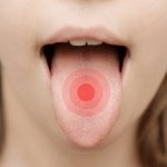 Как избавиться от боли в языке?