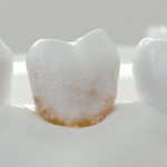 How to get rid of bad breath?