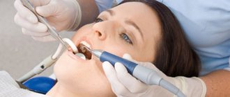 How to remove tartar using ultrasound photo