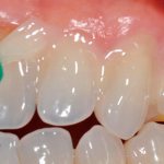 какая процедура проводится детям