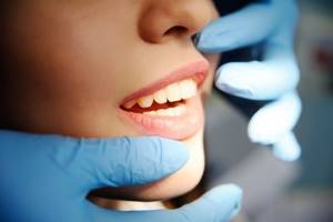 кариес зубов причины возникновения профилактика лечение