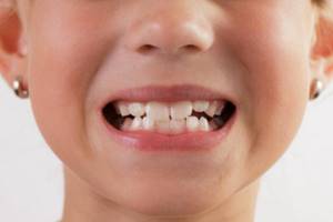 Коренные зубы у ребенка
