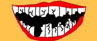 Teeth are crumbling
