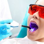 лазерная чистка зубов