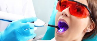laser teeth cleaning