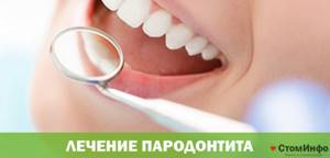 Лечение пародонтита у стоматолога