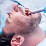 Лечение подвижности зубов - Алкоклиник