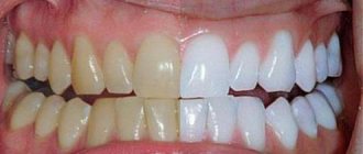 magic white отбеливание зубов отзывы стоматологов