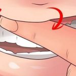 Массаж десен пальцами после удаления зуба