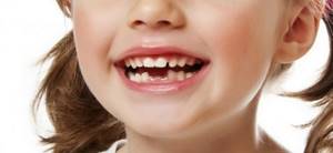Меняются ли коренные зубы у детей