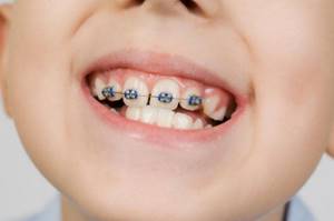 моляры зубы у ребенка