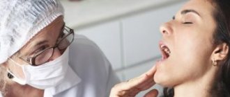 мукозит полости рта, что это такое