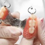 rubbing dentures what to do