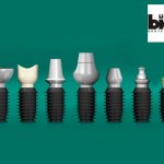 Обзор имплантов Bicon