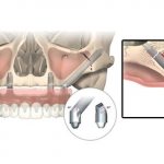 Особенности конструкции
