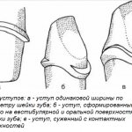 Особенности препарирования молочных зубов