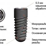 Особенности производства