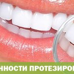 Features of prosthetics