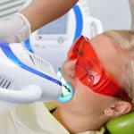 Отбеливание зубов Beyond - Стоматология Линия Улыбки